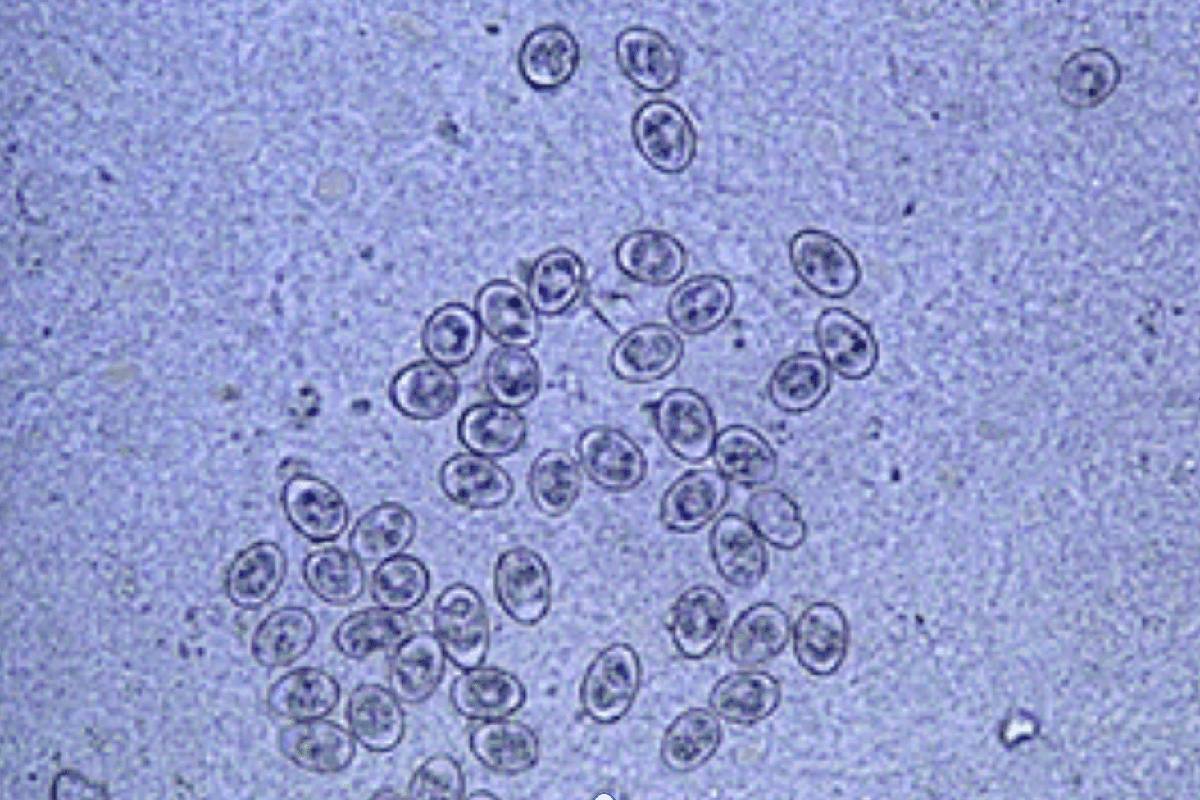 Coccidial oocysts under a microscope